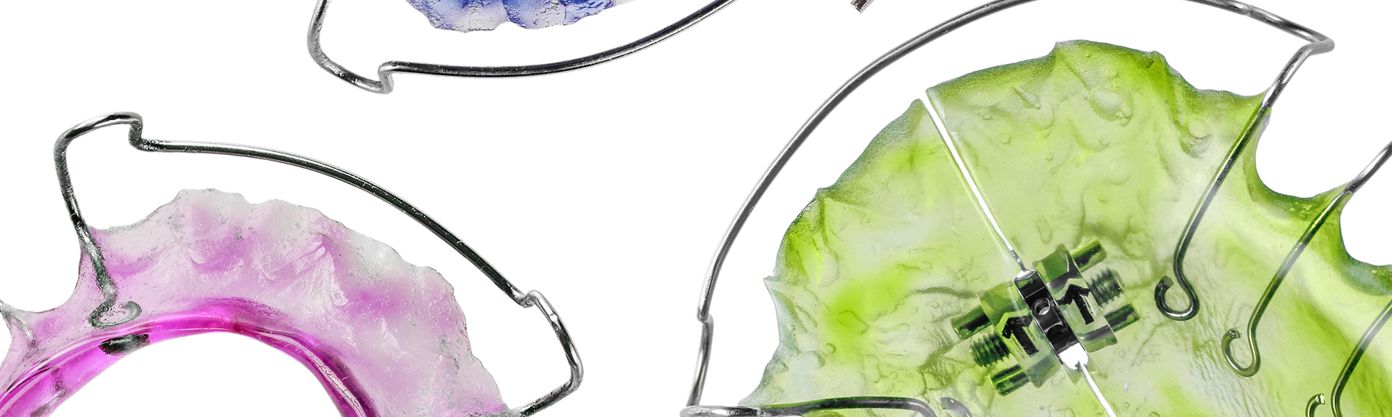 Long-Term Retainer Care: How to Avoid Surprises Years Later